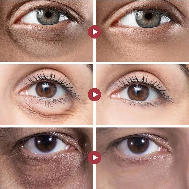 LuminaSkin Serum rejuvenecedor contra olheiras.
